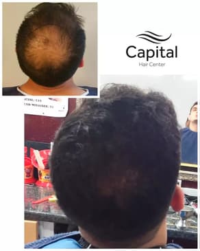 Slider image (9) Capital Hair Center